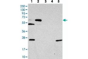 Western blot analysis of Lane 1: RT-4, Lane 2: U-251 MG, Lane 3: Human Plasma, Lane 4: Liver, Lane 5: Tonsil with C10orf33 polyclonal antibody . (PYROXD2 anticorps)