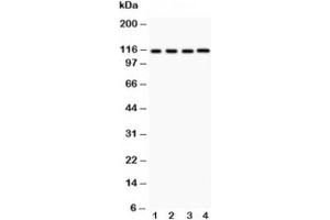 Western blot testing of NALP3 antibody and Lane 1:  HeLa;  2: MCF-7;  3: Jurkat;  4: HEPG2