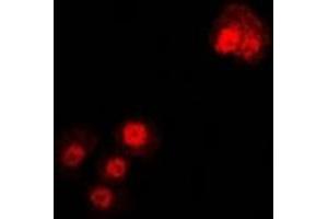 Immunofluorescent analysis of Alpha-tubulin 4a staining in U2OS cells.