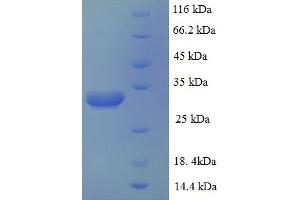SDS-PAGE (SDS) image for Solute Carrier Family 39 (Zinc Transporter), Member 1 (SLC39A1) (AA 126-179) protein (His tag) (ABIN5713118)