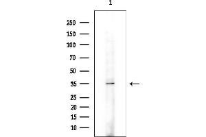 anti-Ubiquitin Thioesterase OTU1 (YOD1) (Internal Region) antibody