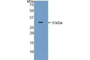 Detection of Recombinant GHR, Mouse using Polyclonal Antibody to Growth Hormone Receptor (GHR) (Growth Hormone Receptor anticorps  (AA 36-266))