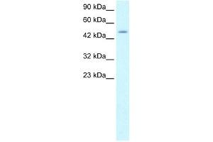 WB Suggested Anti-ZNF365 Antibody Titration: 1. (ZNF365 anticorps  (N-Term))
