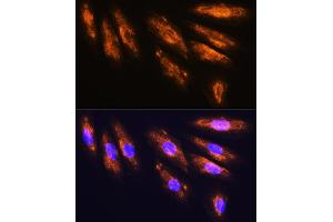 Immunofluorescence analysis of H9C2 cells using NMDA Rabbit pAb (ABIN1681064, ABIN3015387, ABIN3015389 and ABIN6214028) at dilution of 1:100.