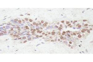 Immunohistochemistry (IHC) image for anti-Nuclear Receptor Coactivator 2 (NCOA2) (C-Term) antibody (ABIN7448683) (NCOA2 anticorps  (C-Term))