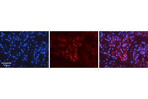 Rabbit Anti-RET Antibody Catalog Number: ARP30878_P050 Formalin Fixed Paraffin Embedded Tissue: Human Testis Tissue Observed Staining: Cytoplasm Primary Antibody Concentration: 1:600 Other Working Concentrations: N/A Secondary Antibody: Donkey anti-Rabbit-Cy3 Secondary Antibody Concentration: 1:200 Magnification: 20X Exposure Time: 0. (Ret Proto-Oncogene anticorps  (C-Term))