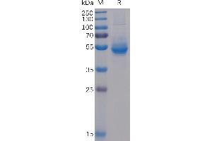 Human ICOS Protein, mFc-His Tag on SDS-PAGE under reducing condition.