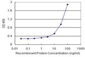CTH (Human) Matched Antibody Pair