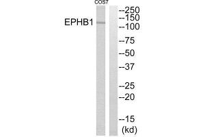 Western Blotting (WB) image for anti-EPH Receptor B1 (EPHB1) (C-Term) antibody (ABIN1852705) (EPH Receptor B1 anticorps  (C-Term))