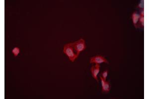 ABIN6274009 staining HeLa cells by ICC/IF. (ENO1 anticorps  (C-Term))