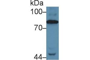 Western Blot; Sample: Human Serum; Primary Ab: 5µg/ml Rabbit Anti-Human C4 Antibody Second Ab: 0. (Complement C4 anticorps  (AA 975-1336))