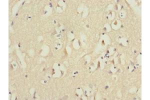 Immunohistochemistry of paraffin-embedded human brain tissue using ABIN7151071 at dilution of 1:100 (MID1 anticorps  (AA 478-667))