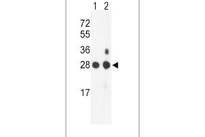 Western blot analysis of PSMB1 Antibody (C-term) (ABIN652802 and ABIN2842525) in mouse NIH-3T3 cell line(lane 1) and mouse bladder tissue(lane 2) lysates (35 μg/lane). (PSMB1 anticorps  (C-Term))