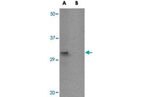 Western blot analysis of ACOT13 in HepG2 cell lysate with ACOT13 polyclonal antibody  at 1 ug/mL in (A) the absence and (B) the presence of blocking peptide. (THEM2 anticorps  (C-Term))