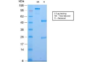 SDS-PAGE Analysis of Purified CELA3B Rabbit Recombinant Monoclonal Antibody (CELA3B/2810R).