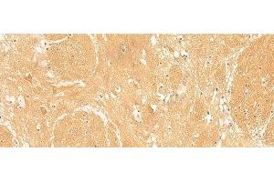 Immunohistochemistry of paraffin-embedded Human brain tissue using ARPC5L Polyclonal Antibody at dilution of 1:30(x200) (ARPC5L anticorps)