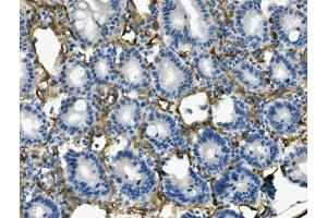 IHC analysis of MCAM using anti-MCAM antibody (ABIN7601026). (MCAM anticorps  (AA 27-621))