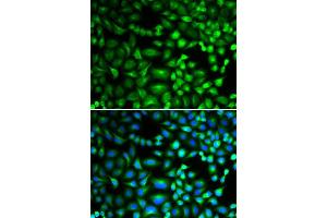 Immunofluorescence analysis of A549 cell using EIF5A antibody.