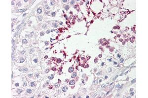 Anti-ATP10D antibody IHC of human testis.
