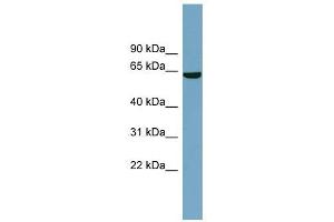 SLC5A8 antibody used at 1 ug/ml to detect target protein. (SLC5A8 anticorps)