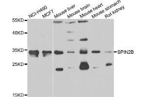 Western blot analysis of extracts of various cell lines, using SPIN2B antibody (ABIN4905283) at 1:1000 dilution. (Spindlin 2B anticorps)