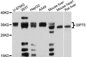 Western blot analysis of extracts of various cell lines, using SIRT5 antibody (ABIN5973406) at 1/1000 dilution. (SIRT5 anticorps)