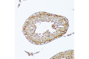 Immunohistochemistry of paraffin-embedded rat testis using Cortactin Rabbit mAb (ABIN7266511) at dilution of 1:100 (40x lens). (Cortactin anticorps)