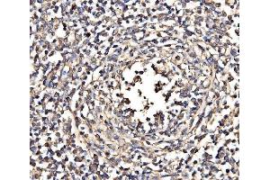 IHC analysis of NEAS/SPTAN1 using anti-NEAS/SPTAN1 antibody (ABIN7600436). (SPTAN1 anticorps  (AA 1916-2472))
