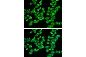 Immunofluorescence analysis of A549 cells using HADHB antibody. (HADHB anticorps  (AA 34-270))