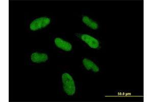 Immunofluorescence of purified MaxPab antibody to DGCR6 on HepG2 cell.