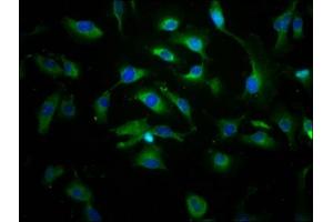 Immunofluorescence staining of U251 cells with ABIN7144904 at 1:166, counter-stained with DAPI.