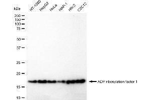 Western blotting analysis using ADP ribosylation factor 1 antibody (ABIN7797530). (Recombinant ARF1 anticorps)