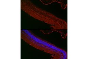 Immunofluorescence analysis of mouse retina cells using RPGR Rabbit pAb (ABIN3015609, ABIN3015610, ABIN3015611, ABIN1682567 and ABIN6218971) at dilution of 1:50 (40x lens). (RPGR anticorps  (AA 1-260))