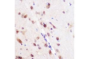 Immunohistochemistry of paraffin-embedded Rat brain using CELF1 Rabbit pAb (ABIN6131012, ABIN6138399, ABIN6138400 and ABIN6221641) at dilution of 1:100 (40x lens).