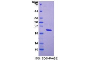 SDS-PAGE (SDS) image for Natriuretic Peptide A (NPPA) (AA 25-152) protein (His tag) (ABIN1878726) (NPPA Protein (AA 25-152) (His tag))