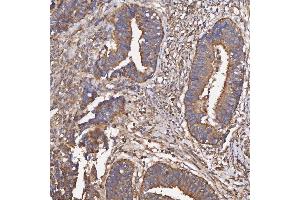 IHC analysis of HSD11B2 using anti-HSD11B2 antibody (ABIN7602698).