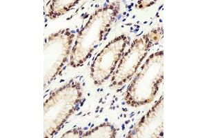 Immunohistochemical analysis of paraffin-embedded H. (CSE1L anticorps  (N-Term))