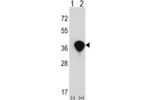 Western Blotting (WB) image for anti-Transaldolase 1 (TALDO1) antibody (ABIN3002744)