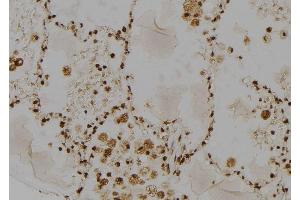 ABIN6277485 at 1/100 staining Human lung tissue by IHC-P. (RAD23A anticorps  (C-Term))