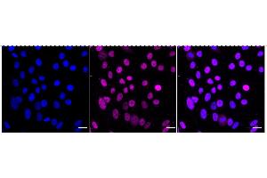 Immunocytochemical staining of HepG2 cells with Lysine demethylase 1B antibody (ABIN7799298), 1:1,000). (Recombinant KDM1B anticorps)