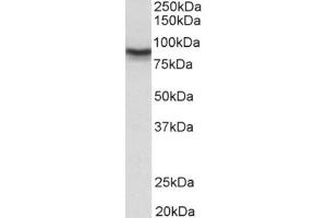 Staining of Mouse Brain lysate usng DLG4 / PSD95 antibody at 0. (DLG4 anticorps  (Internal Region))