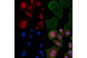ABIN6263312 and ABIN6266806 staining Hela cells by IF/ICC. (Meningioma 1 anticorps  (Internal Region))