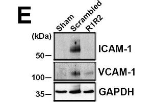 R1R2 decreases inflammatory cell accumulation and VCAM-1 and ICAM-1 levels. (ICAM1 anticorps)