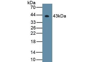 Detection of Recombinant HDAC11, Mouse using Polyclonal Antibody to Histone Deacetylase 11 (HDAC11) (HDAC11 anticorps  (AA 1-347))
