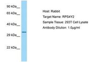 Image no. 1 for anti-Ribosomal Protein S4, Y-Linked 2 (RPS4Y2) (AA 166-215) antibody (ABIN6749893) (RPS4Y2 anticorps  (AA 166-215))