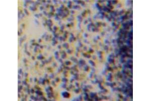 Used in DAB staining on fromalin fixed paraffin-embedded Spleen tissue (ACP5 anticorps  (AA 28-286))
