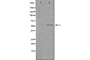 Western blot analysis of extracts from HeLa cells, using SERC2 antibody.