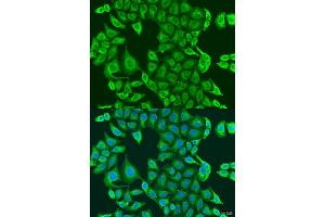 Immunofluorescence analysis of U2OS cells using PDK2 antibody (ABIN1681304, ABIN3018413, ABIN3018414 and ABIN6220461) at dilution of 1:100. (PDK2 anticorps  (AA 128-407))