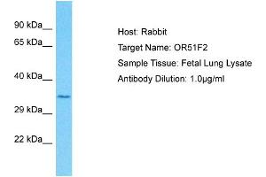 Host: Rabbit Target Name: OR51F2 Sample Type: Fetal Lung lysates Antibody Dilution: 1. (OR51F2 anticorps  (C-Term))
