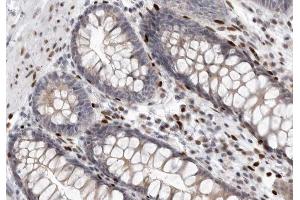 ABIN6266509 at 1/200 staining human colon tissue sections by IHC-P.